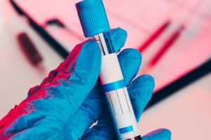 MDMA in Urine Journey Hillside Tarzana feature image