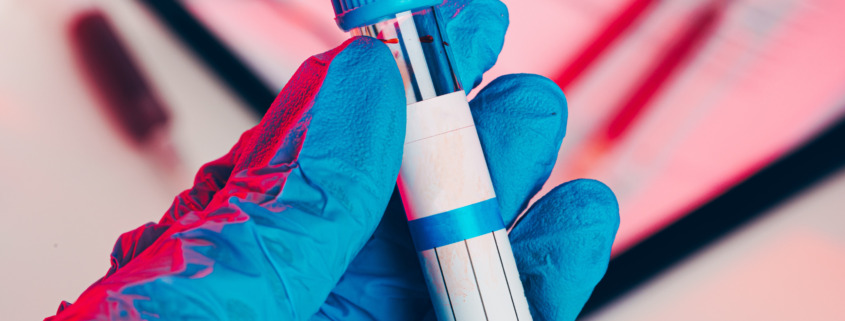 MDMA in Urine Journey Hillside Tarzana feature image