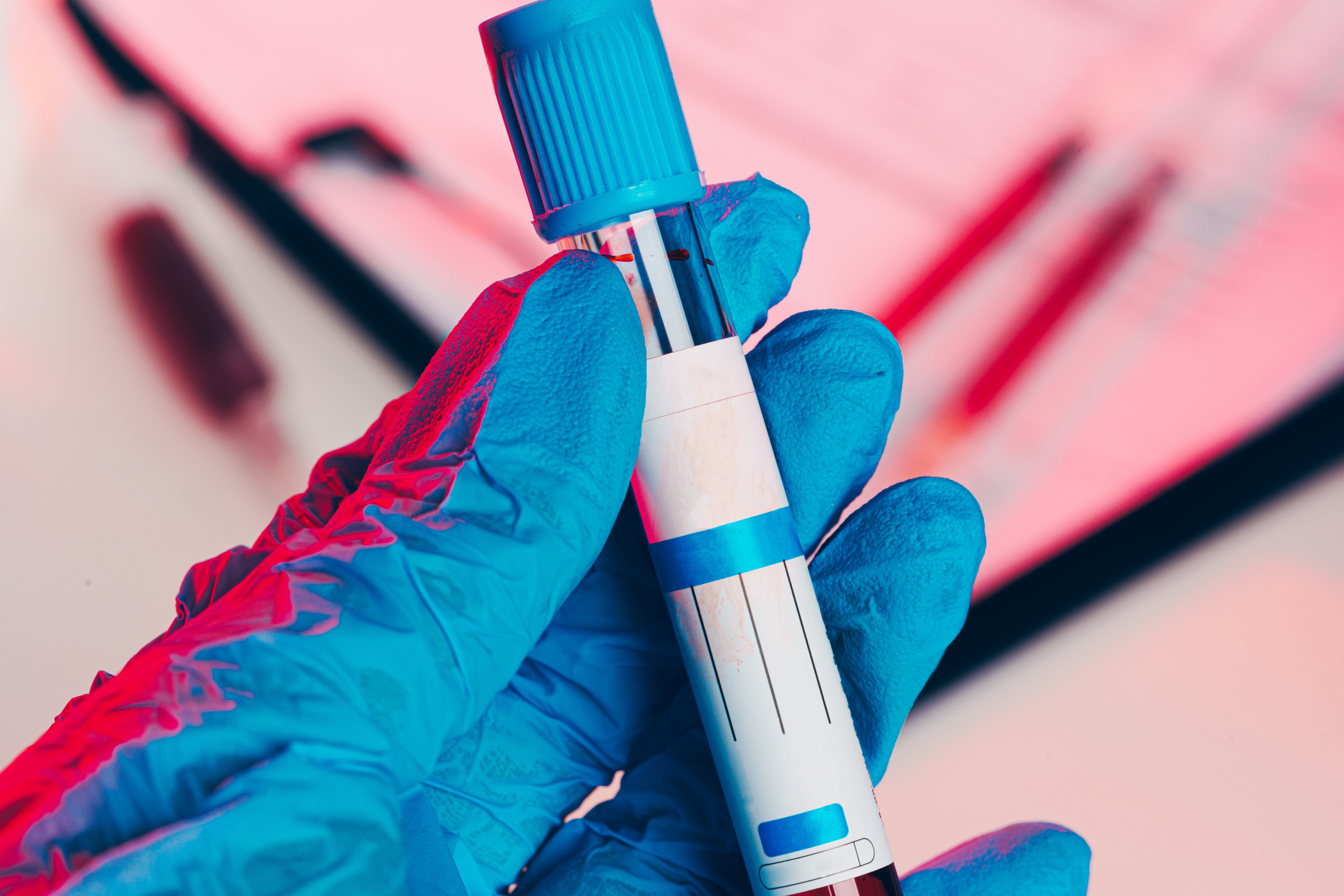 MDMA in Urine Journey Hillside Tarzana feature image