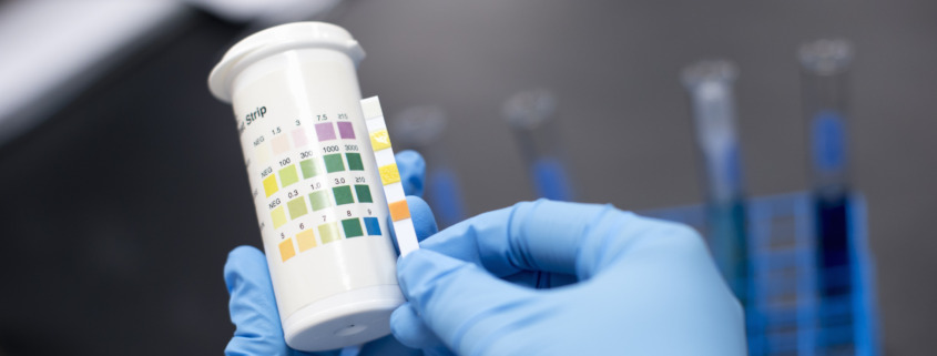 how long does kratom stay in your system journey hillside tarzana feature