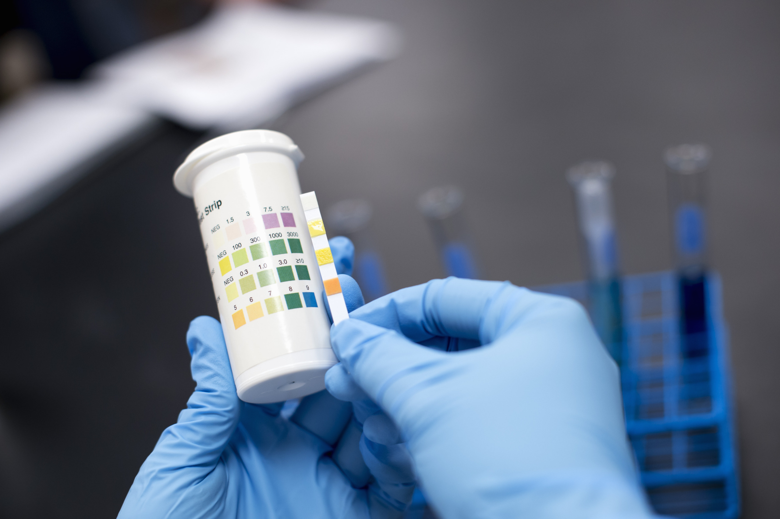 how long does kratom stay in your system journey hillside tarzana feature